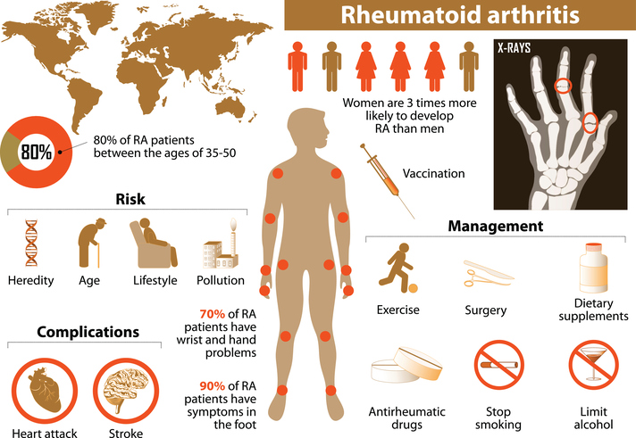 autoimmune rheumatoid arthritis