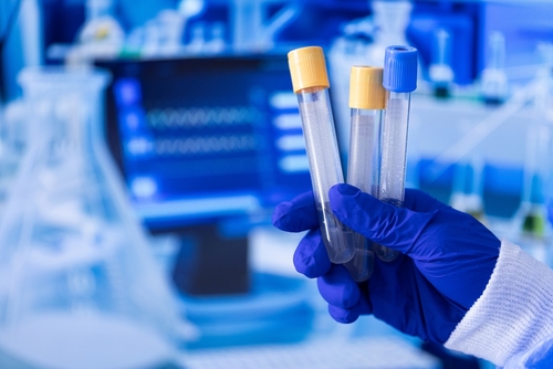 Blog Image: Compounded Weight Medications Fort Wayne